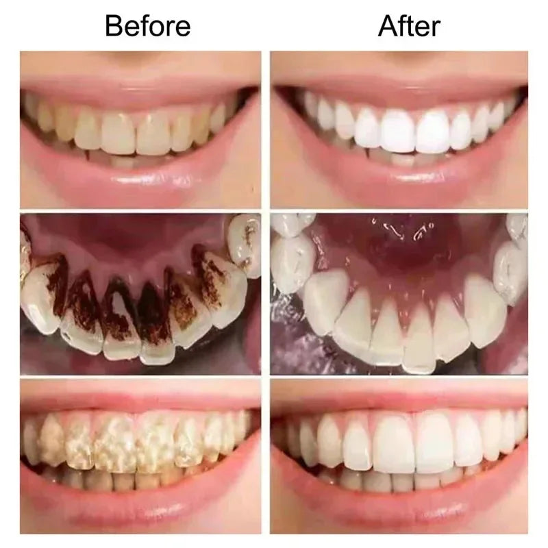 V-34 Purple Teeth Whitening Toothpaste Removal Stains Smoke Coffee Plaque Tooth Whitener Corrector Clean Oral Dental Bleach Care